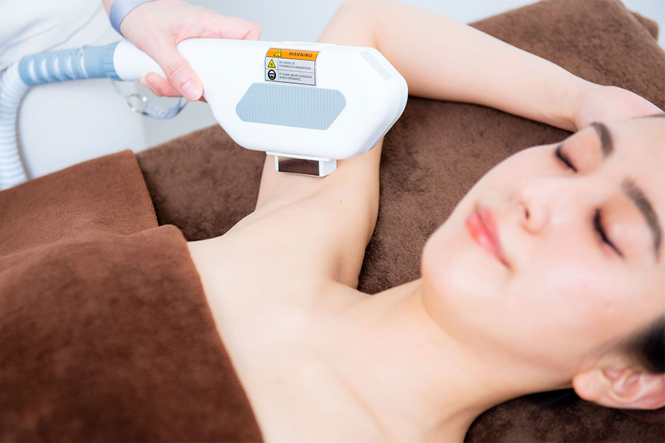 脱毛全身イメージ